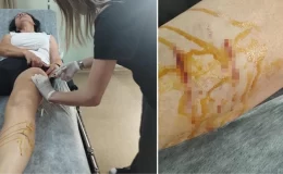 Sabah sporunda kabusu yaşadı! Talihsiz kadın başıboş köpeklerin saldırısında yaralandı